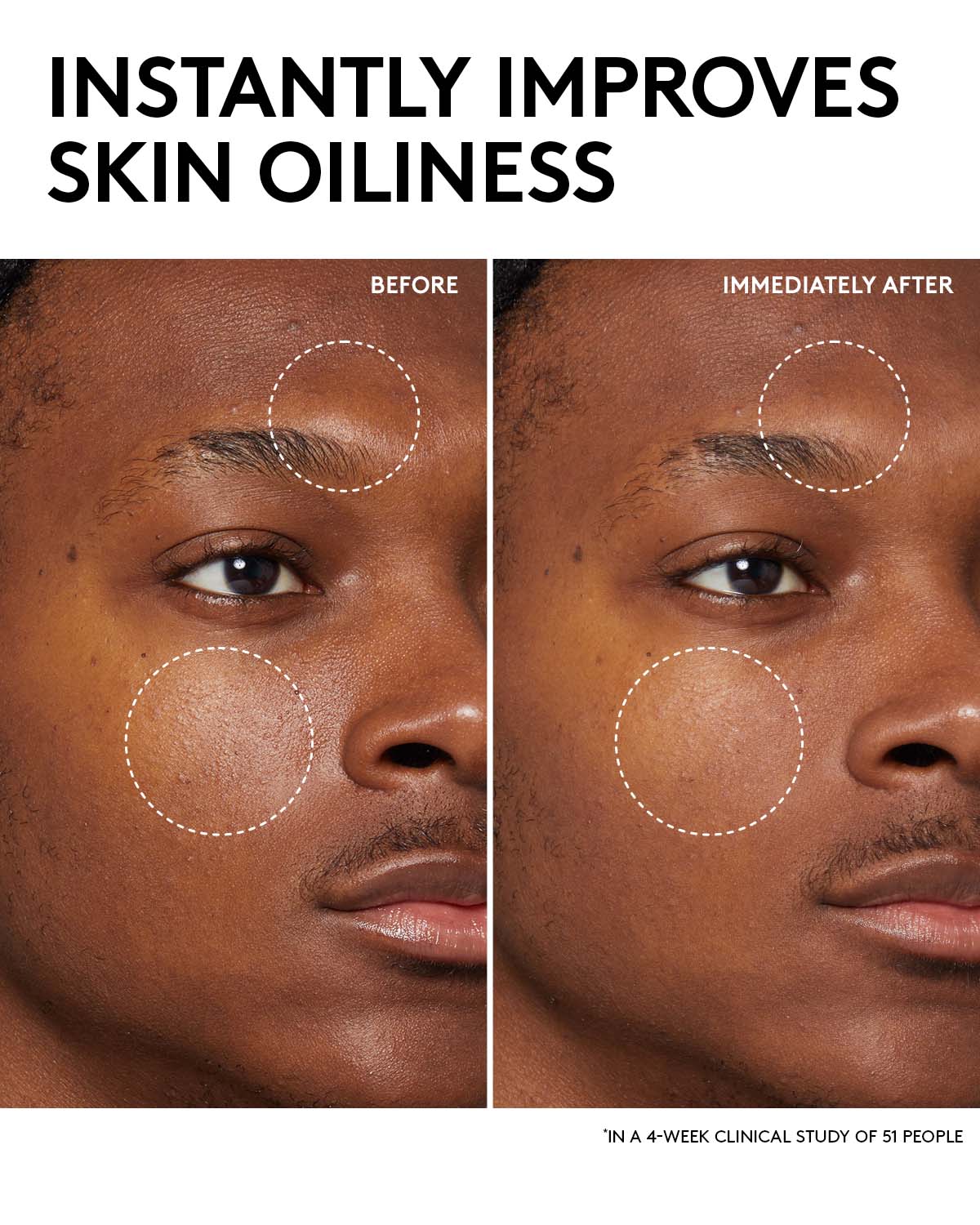 Fenty Skin Start'rs Full-Size Bundle: Oily Skin Edition - Image 12