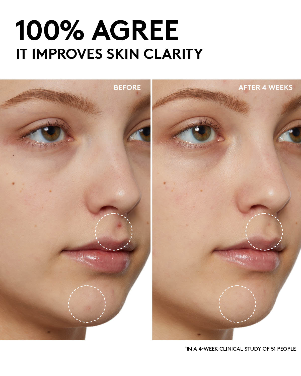 Fenty Skin Start'rs Full-Size Bundle: Oily Skin Edition - Image 13