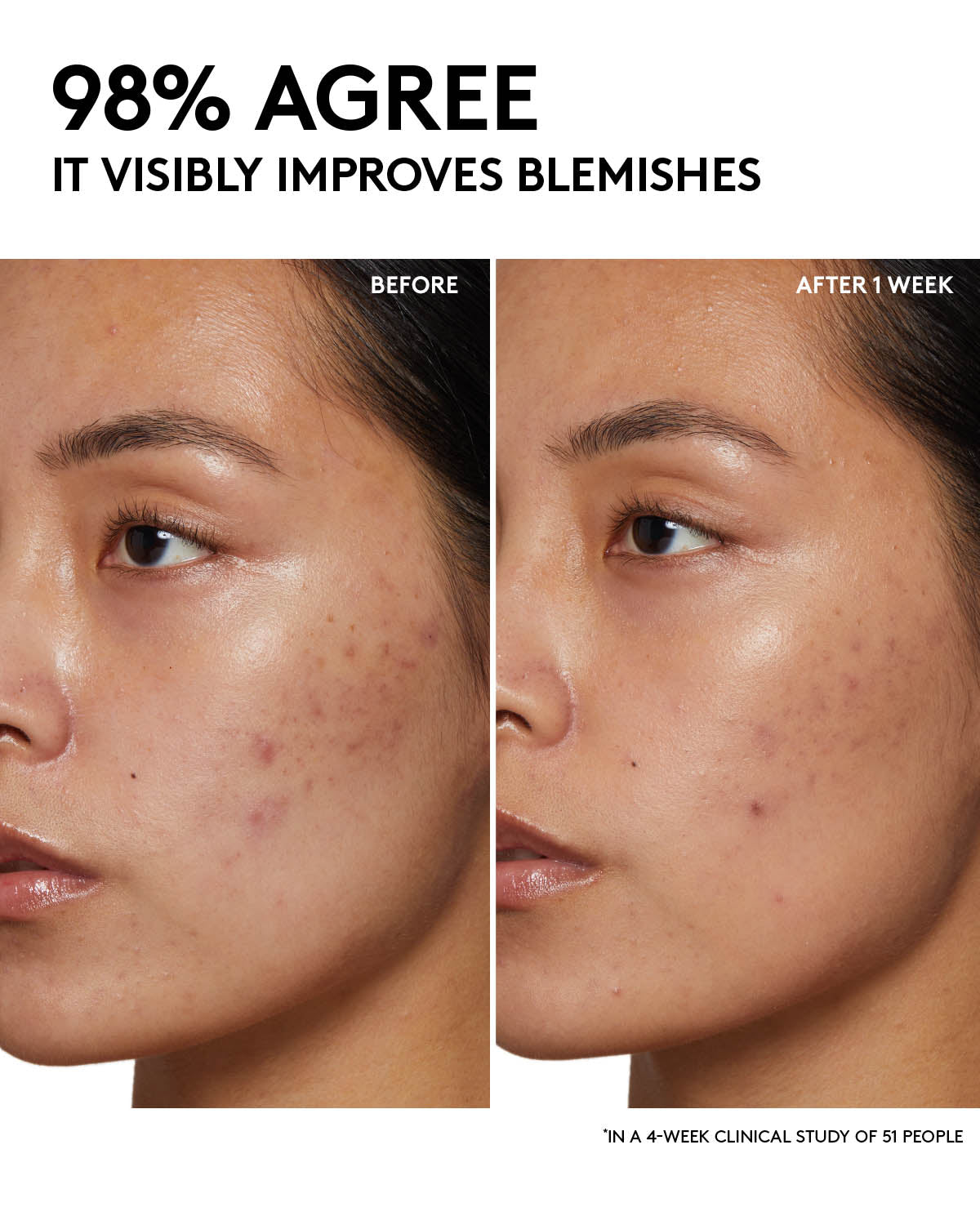 Fenty Skin Start'rs Full-Size Bundle: Oily Skin Edition - Image 14