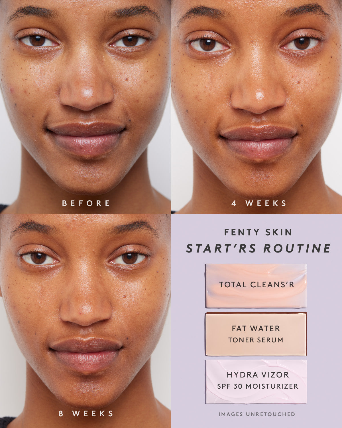 Fenty Skin Vault 5-Piece AM + PM Skincare Essentials - Image 3